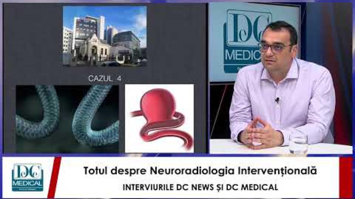 Neuroradiologia Intervențională, cu Dr Cristian MIHALEA. Interviurile DC News și DC Medical