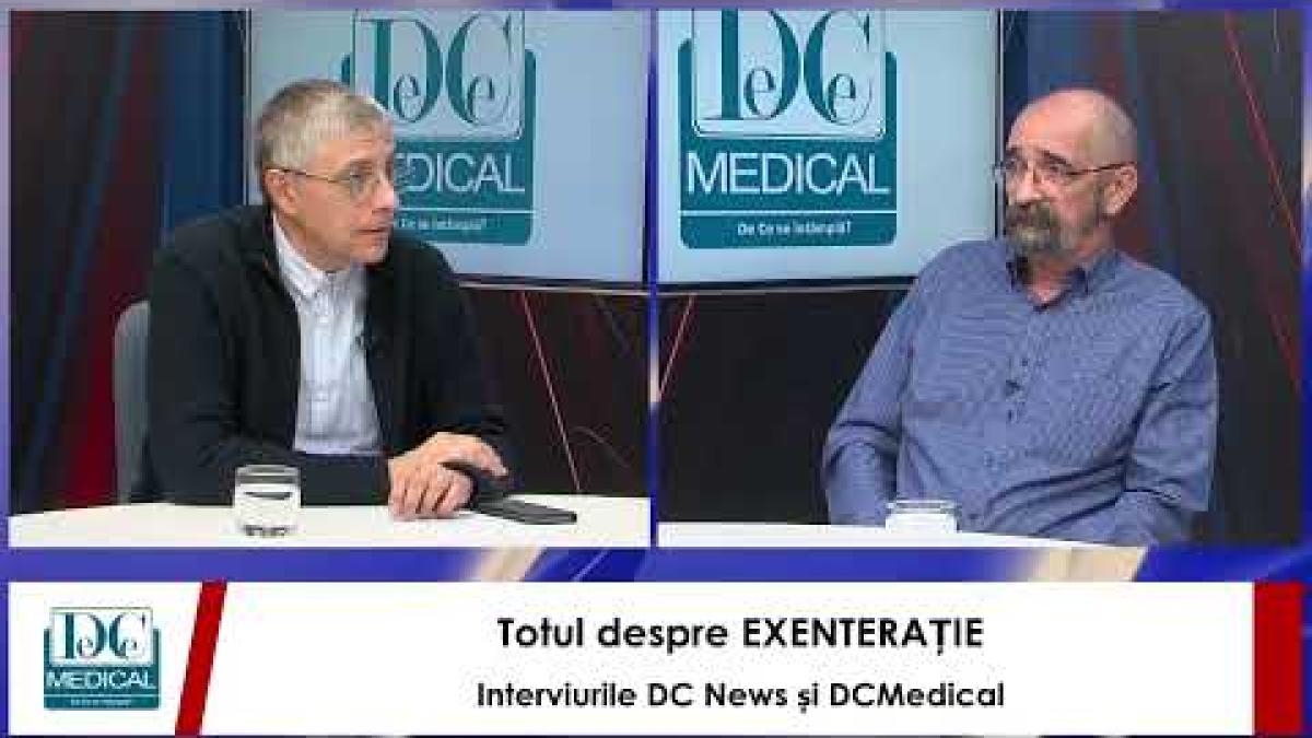 Totul despre EXENTERAȚIE, cu dr Gabriel MITULESCU (SANADOR). Interviurile DCNews și DCMedical