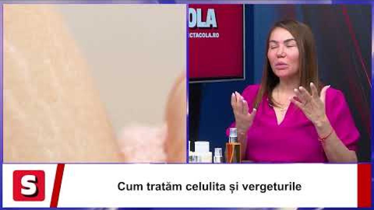 Nu-ți mai face probleme pentru celulită și vergeturi! Ioana Marinescu, mesaj pentru toate femeile