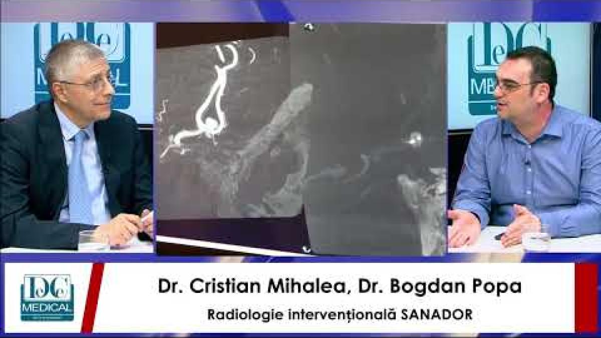 Radiologie intervențională și anevrism. Cristian Mihalea și Bogdan Popa, (SANADOR), la DC News