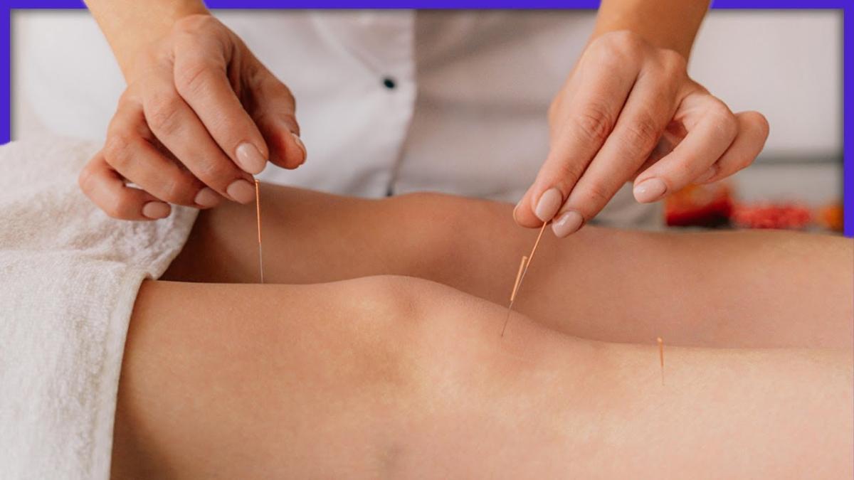 Legătura dintre FIV și acupunctură care crește șansele unei sarcini duse la capăt