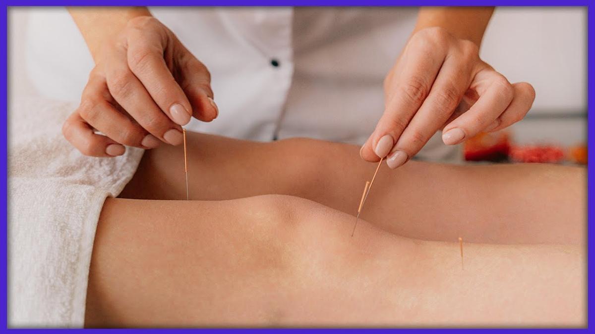 Beneficiile acupuncturii. Florin Bebeșel: „Este un instrument rapid, care face modificări pe loc”
