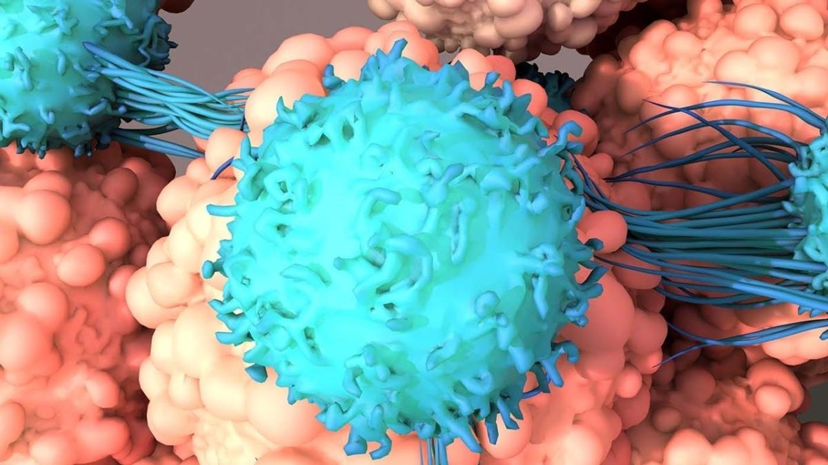 Ce este terapia cu celule CAR-T? Specialist: Viitorul oncologiei, legat de utilizarea acestor terapii