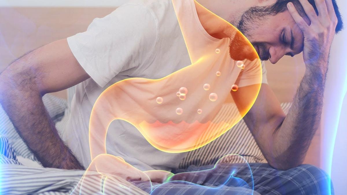 Cum se tratează ulcerul și refluxul gastroesofagian. „Există un risc pe termen lung”