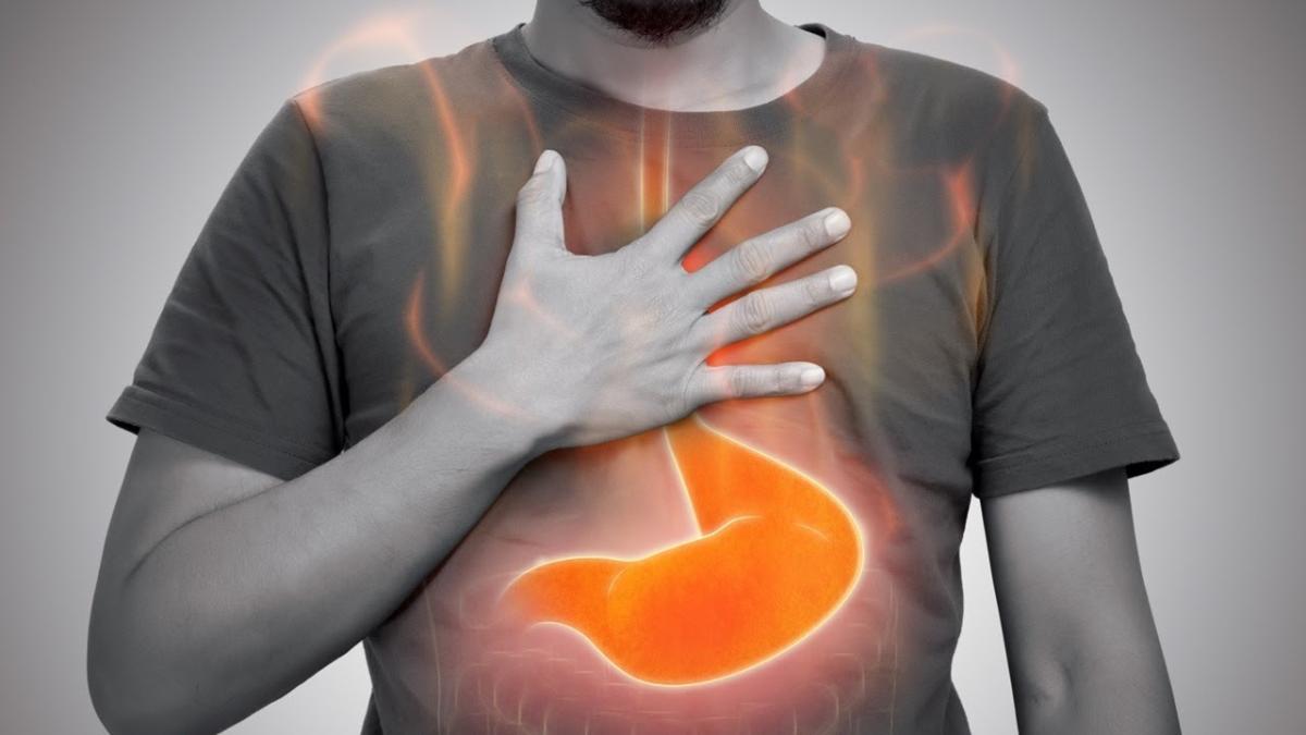 Totul despre cancerul esofagian: bărbații, mai predispuși decât femeile. La ce ajută chirurgia robotică?