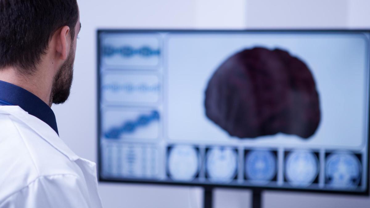 Anevrismele cerebrale. Dr. Corneliu Toader: Importanța cunoașterii antecedentelor familiale, analize și recunoașterea semnelor neurologice