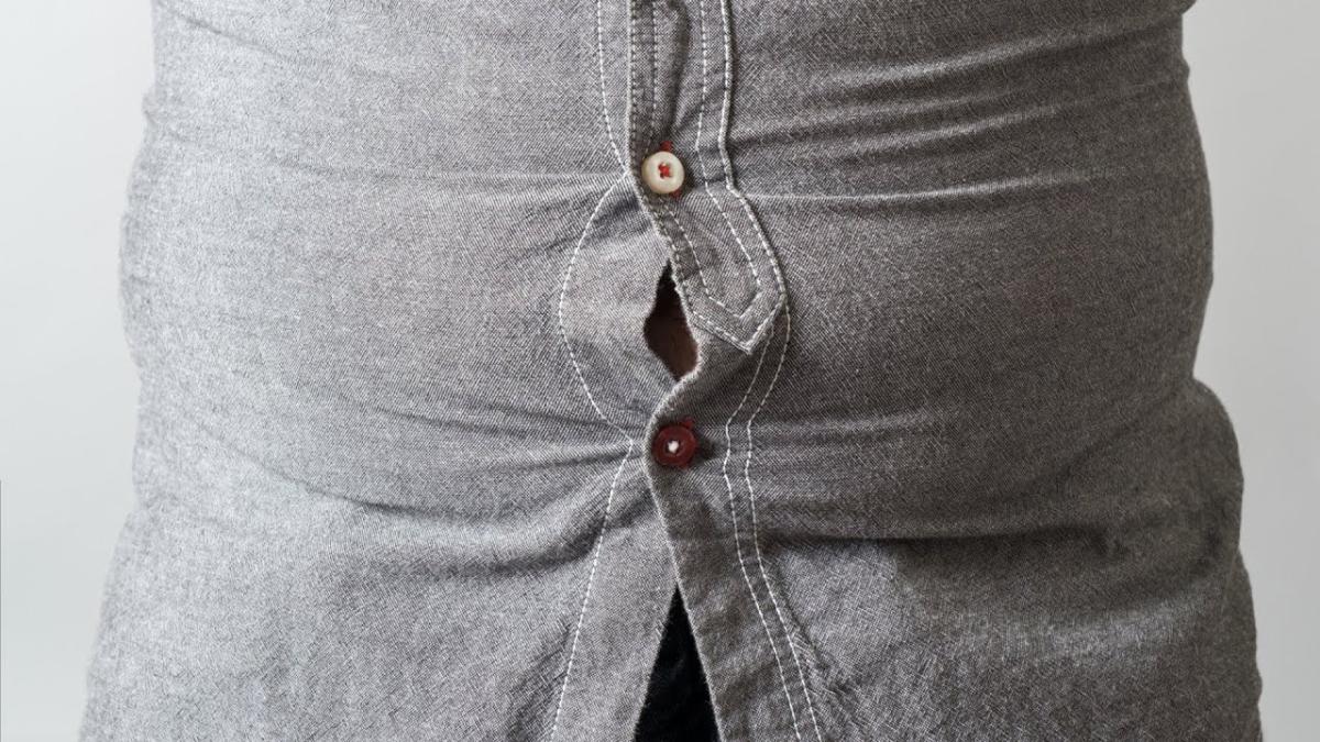 Obezitatea la români. Cifrele îngrijorătoare dezvăluite de un medic chirurg