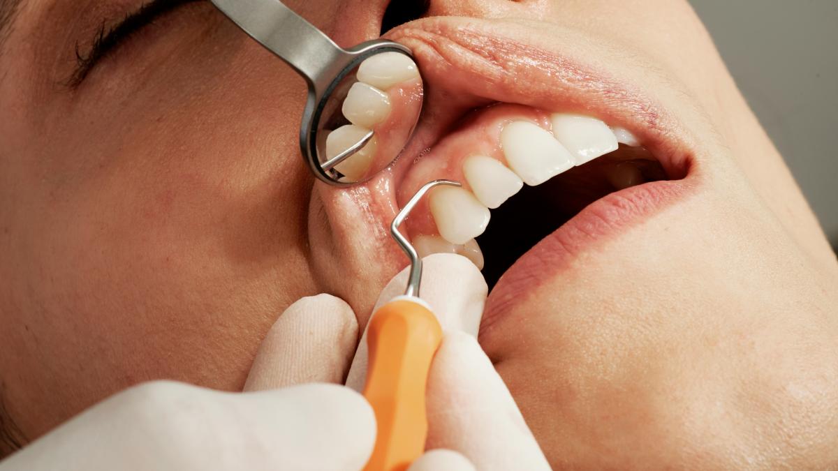 amalgam compozit sau zirconiu dr krilovici si amalia nastase despre materialele care ne afecteaza sanatatea dentara