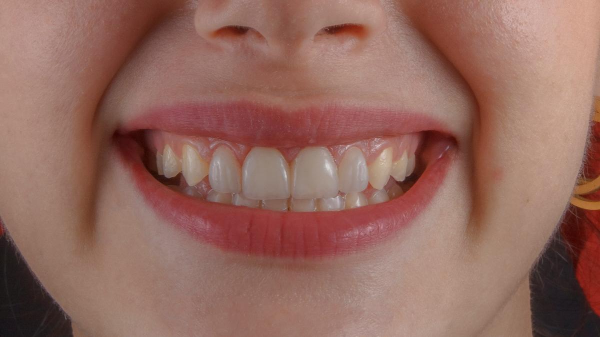 ozkan-guner-7Mut2WMWttA-unsplash