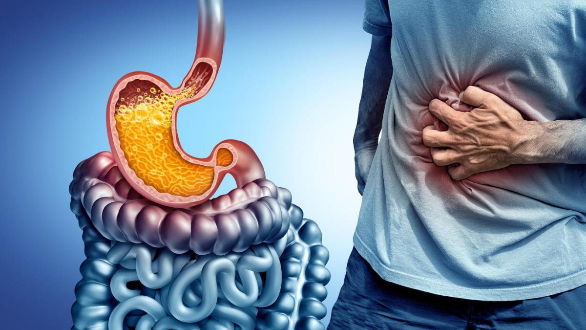 Boala de reflux, cum se tratează și cum pot apărea complicații. Un medic specialist oferă detalii